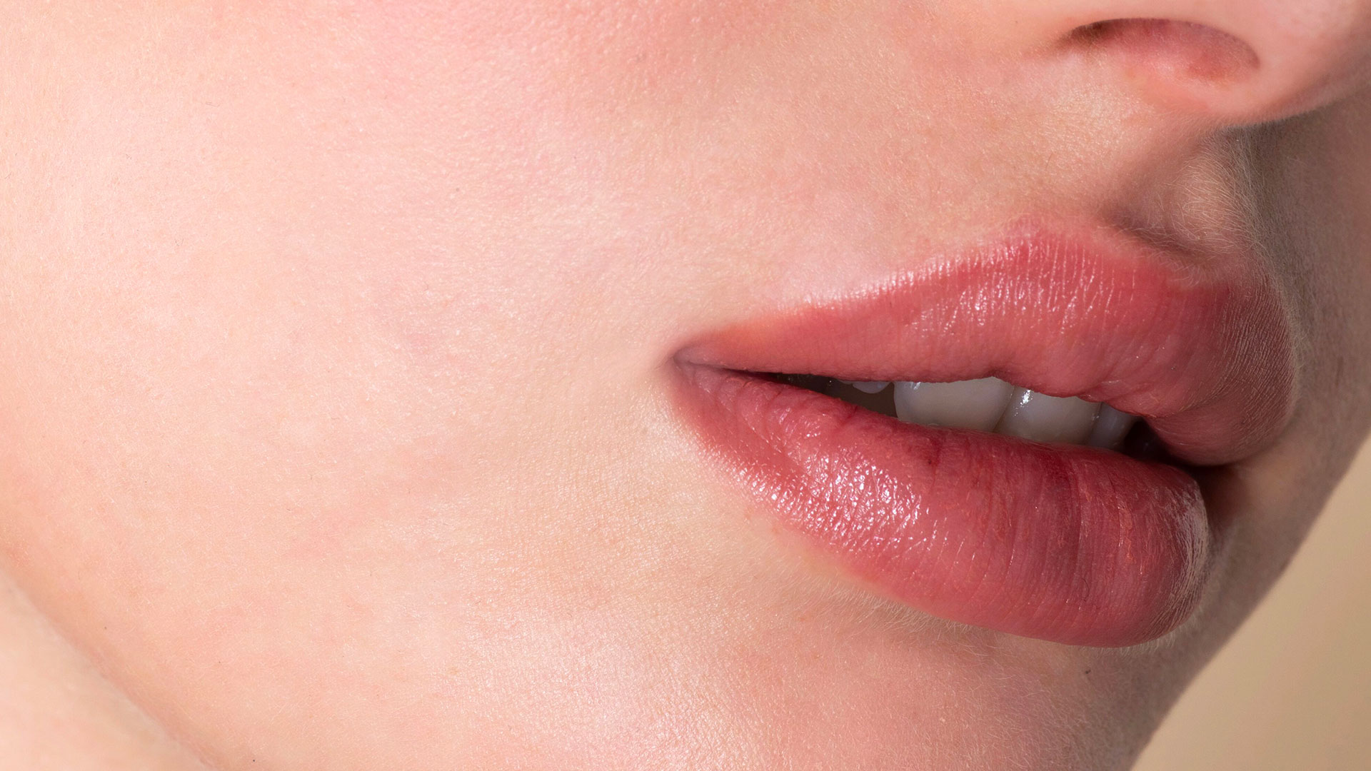 Labios